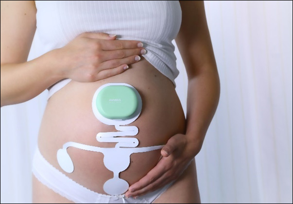 Het Nemo Fetal Monitoring System © Nemo Healthcare B.V. 